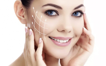 Dermal Fillers 101